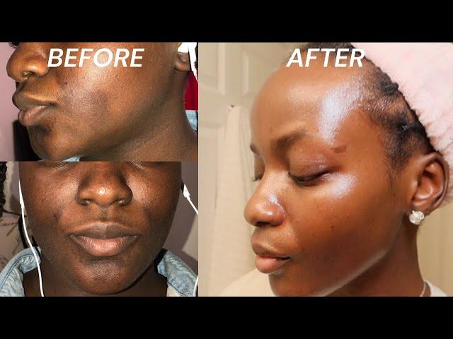 The BEST skincare routine for hyperpigmentation and fine lines | MY MORNING SKINCARE ROUTINE