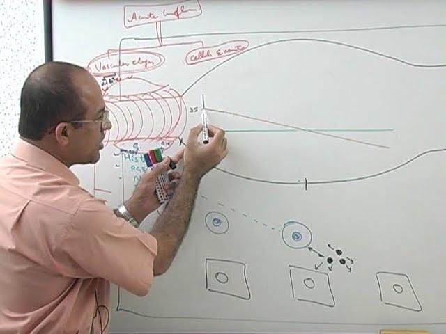 Inflammation | Vascular Events | Immunology | Dr Najeeb