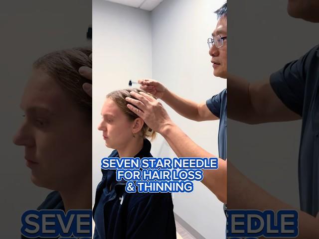 SEVEN STAR NEEDLE FOR HAIR LOSS & THINNING ⭐