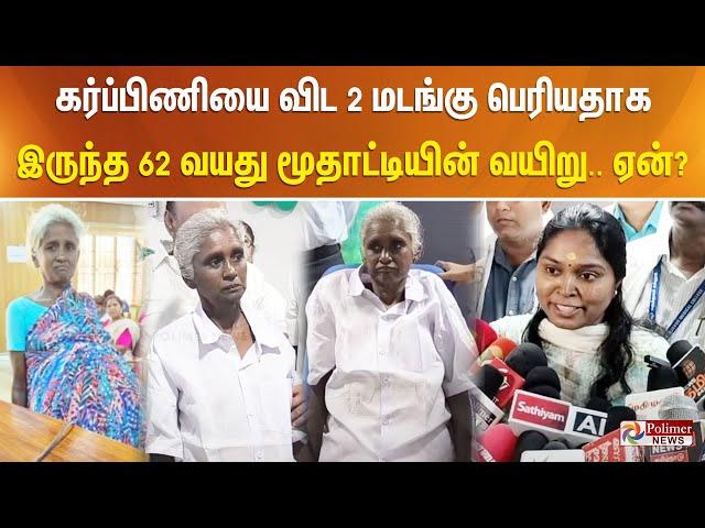 கர்ப்பிணியை விட 2 மடங்கு பெரியதாக இருந்த 62 வயது மூதாட்டியின் வயிறு.. ஏன்?...