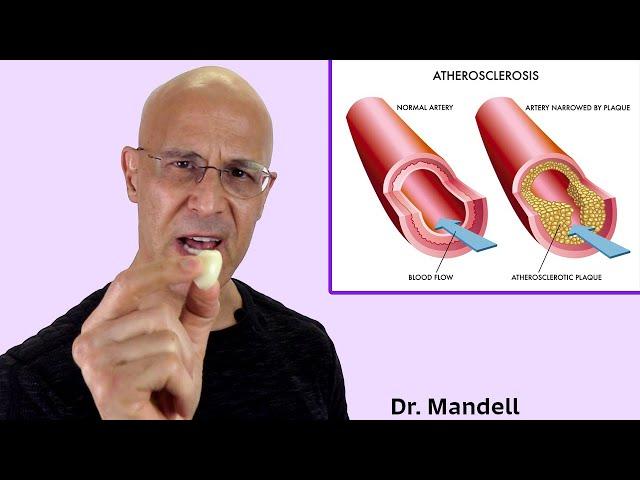 1 Crushed Garlic Clove a Day...Your Heart & Arteries Will Thank You in Many Ways | Dr Mandell