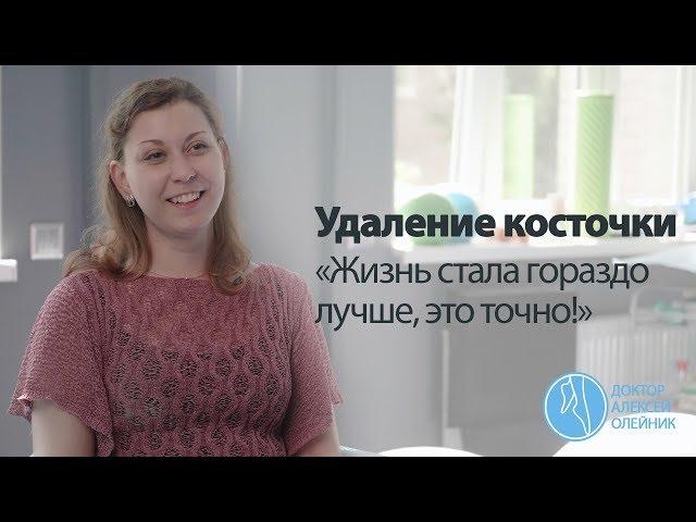 КОСТОЧКИ НА НОГАХ: “Жизнь стала гораздо лучше, это точно!” | Доктор Алексей Олейник