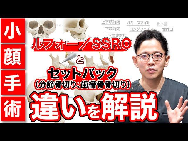 ルフォー／SSROとセットバック（分節骨切り、歯槽骨骨切り）の違い