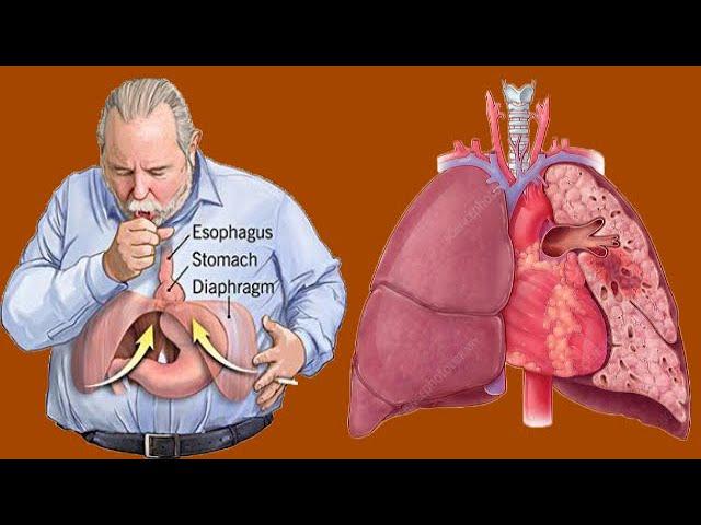 Shortness Of Breath (Dyspnea): Causes And Symptoms