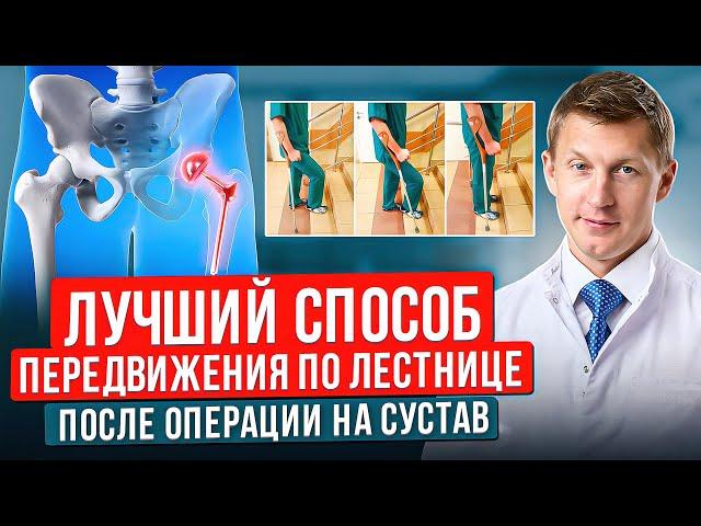 Как Правильно Подниматься и Спускаться По Лестнице После Эндопротезирования Тазобедренного Сустава