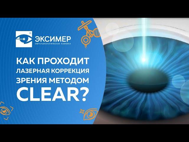 Лазерная коррекция зрения методом CLEAR. Офтальмологическая клиника "Эксимер"