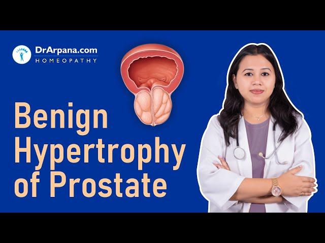 Benign Hypertrophy of Prostrate | Prostrate Enlargement | Homeopathic Medicines by Dr Arpana Samanta