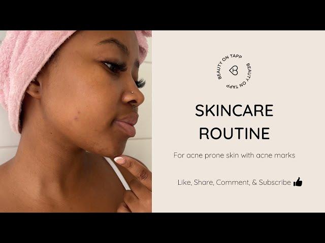 One month skin update with Swazi_Elihle