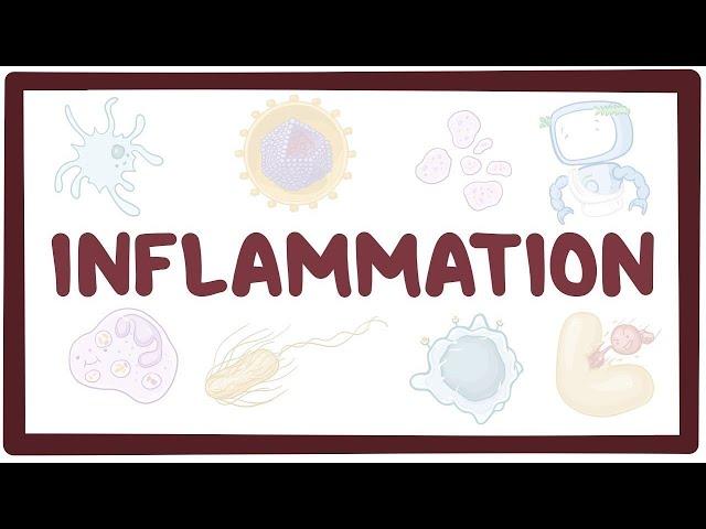 Inflammation - causes, symptoms, diagnosis, treatment, pathology