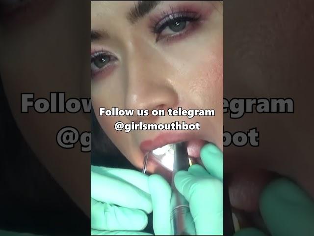 Dentist drilling a woman's teeth  #zahnärztin #zahnärztin #dentist #dentiste #dentista #dentalclinic