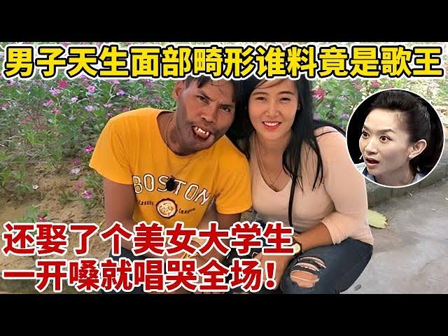 男子天生面部畸形,谁料竟是隐藏歌王!还娶了个美女大学生,一首《你怎么舍得我难过》唱哭全场【王芳王为念访谈】