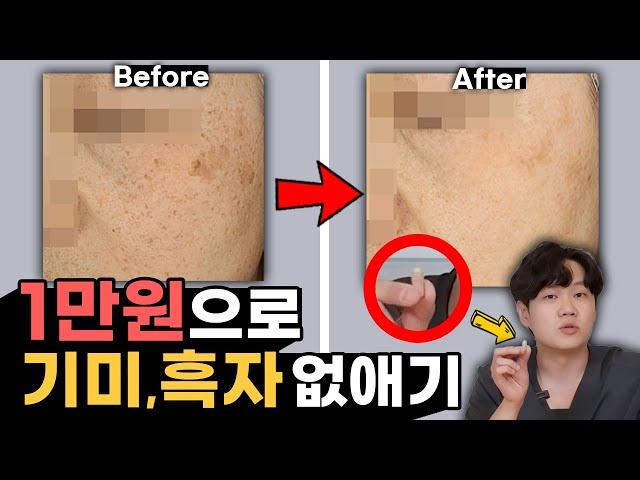 단돈 1만원으로 기미, 흑자 없애기 | 피부과 가기 전에 이것들부터 써보세요!!