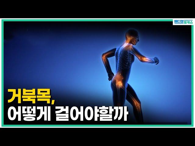 거북목, 평소 어떤 자세와 습관을 가져야할까요? 스트레칭법 알려드립니다! [메디컬포커스]