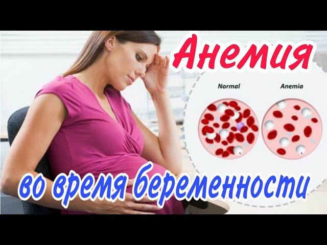 Анемия во время беременности!