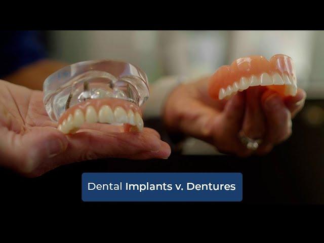 Dental Implants vs. Dentures