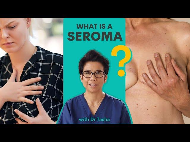 What is a Seroma? - with Dr Tasha