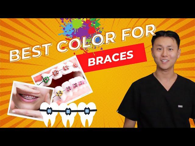 What's the BEST COLOR for my BRACES? | Most Aesthetic Braces Colors