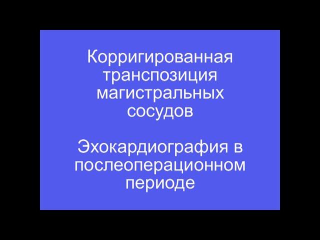 Корригированная транспозиция магистральных артерий, эхокардиография в послеоперационном периоде