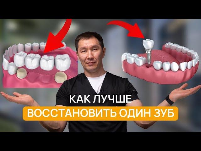 Что выбрать сегодня? МОСТ или ИМПЛАНТ? НЕПРАВИЛЬНЫЙ выбор может УНИЧТОЖИТЬ ваши зубы!