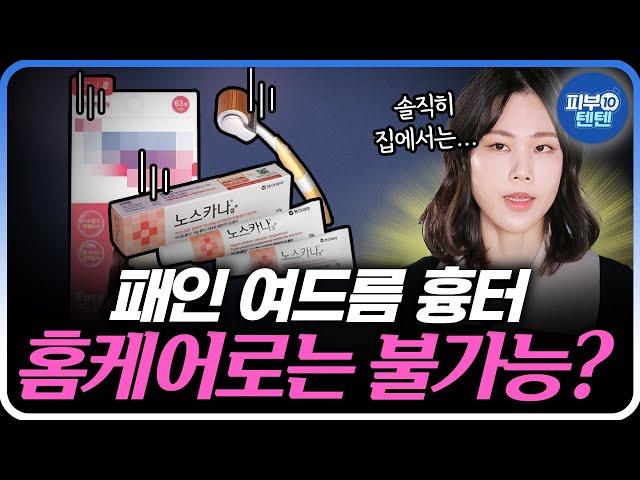[Eng] Every Existing Treatment for  Acne Scars | The Truth About Acne Creams and Patches