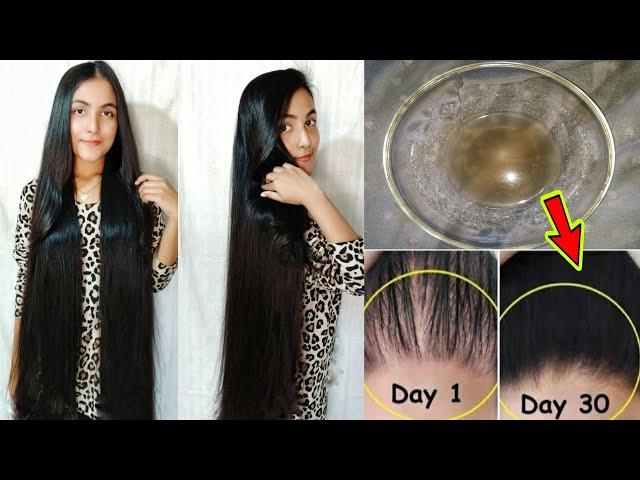 নতুন চুল গজাতে পেঁয়াজের রসের উপকারীতা | How To Use Onion Juice For Hair Regrowth/Extreme Hair Growth