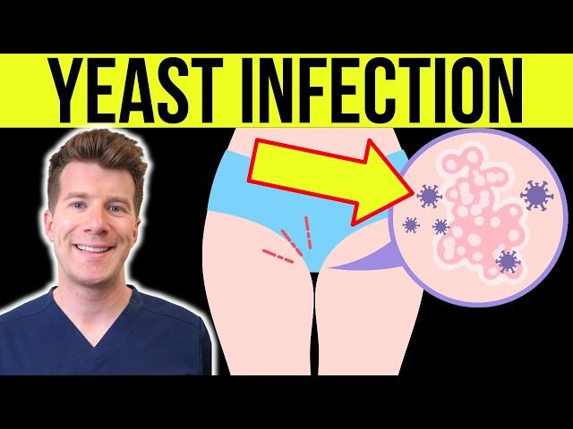 Doctor explains YEAST INFECTION (CANDIDA/THRUSH) in men and women | Causes, Symptoms, Treatment