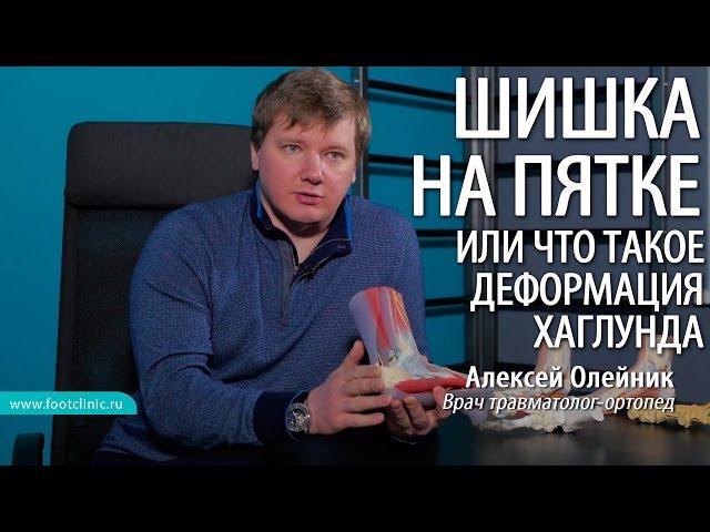 A BUMP ON THE LEG ABOVE THE HEEL or what is the Haglund deformation Aleksey Oleynik #footclinic