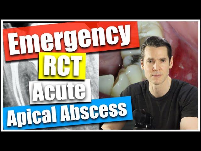 Emergency Root Canal Treatment, William Nudera, Endodontist