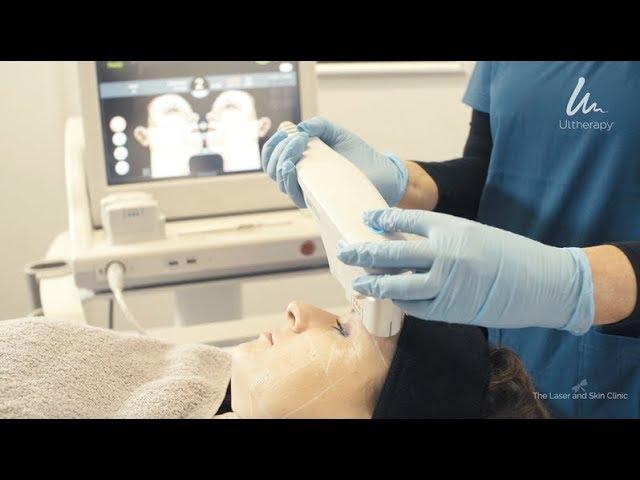 ULTHERAPY - the amazing non-surgical skin lifting treatment