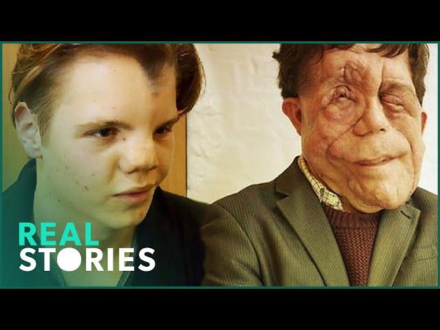 The Ugly Face of Disability Hate Crime (Adam Pearson Documentary) | Real Stories