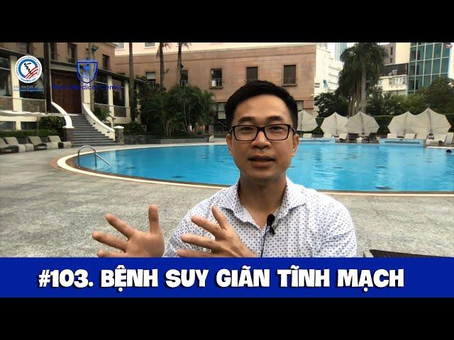 #103. Bệnh suy giãn tĩnh mạch