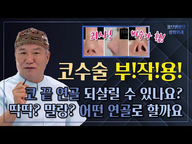 코수술부작용으로 괴사된 비주, 어떤 연골로 되살릴 수 있을까요?