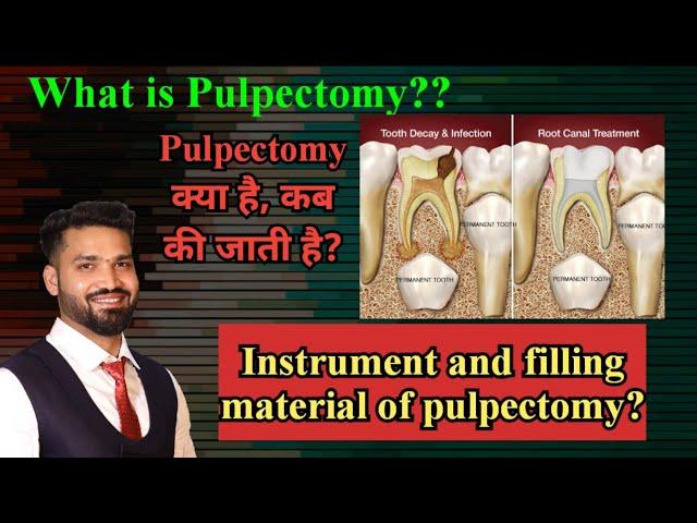 Pulpectomy! Indication, material used and procedure?? (HINDI)