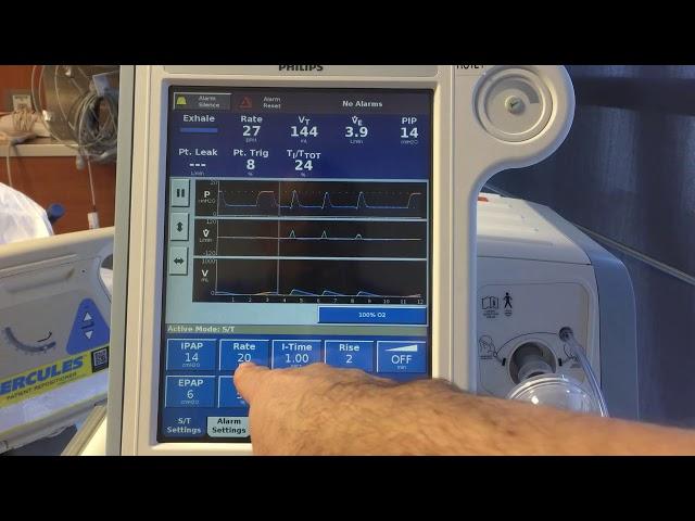 Non-Invasive Ventilation [NIV] - Basics