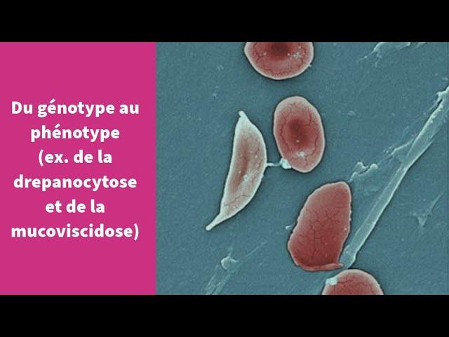 Du génotype au phénotype (ex. de la drépanocytose et de la mucoviscidose) - Première Spécialité SVT