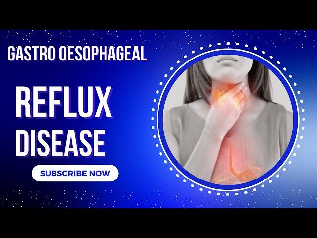 Gastro esophageal reflux disease