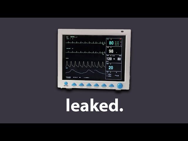 the backdoor in this heart monitor is TERRIFYING