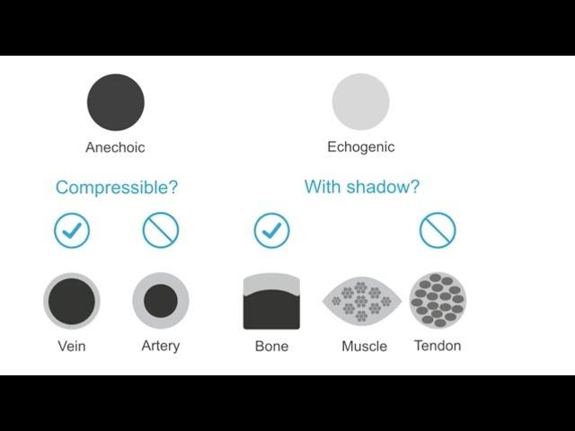 Distinguishing nerves from surrounding structures