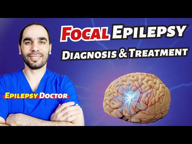 Focal or Partial Epilepsy: Diagnosis and Treatment