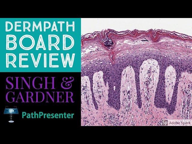 Dermpath Board Review: 100 Classic Cases