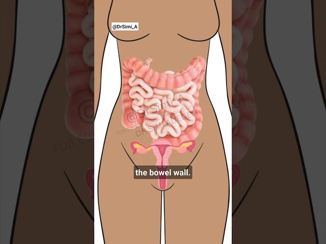  Hard Poo on Your Period | Period Poop Constipation Explained #periods