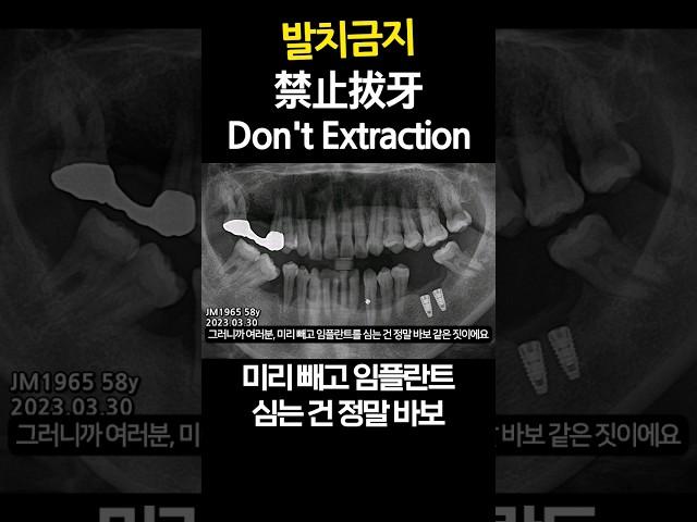 Don't Extraction