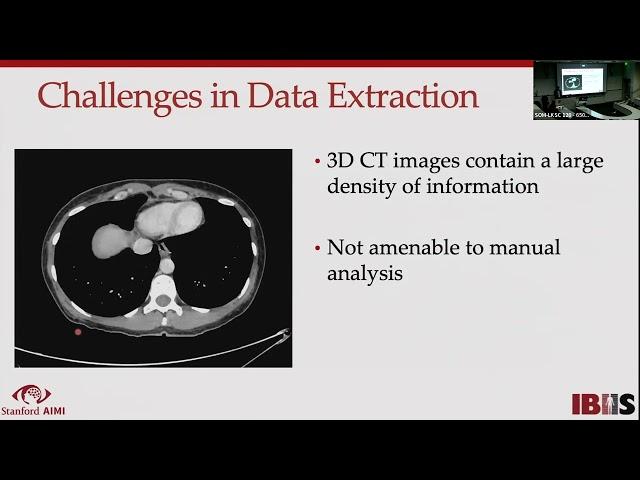 Stanford Radiology: PHIND (Summer) 2022, Chaudhari: Disease Prediction using Imaging & Deep Learning