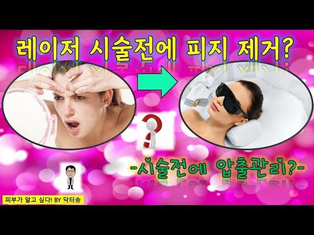 레이저 시술전에 피지제거 필요한가?/레이저 시술전에 피지제거해야하나?/레이저 시술전에 압출관리 필요한가?