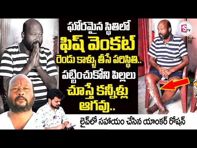 Actor Fish Venkat Emotional Interview | Fish Venkat Health Condition | Roshan Interviews