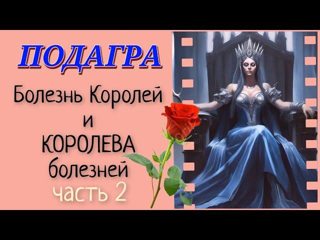 Подагра. Чем лечить. Разбор всех препаратов.