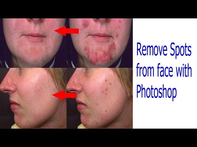Remove spots from face photoshop | Adobe Photoshop CS6 by Sajidz Tech