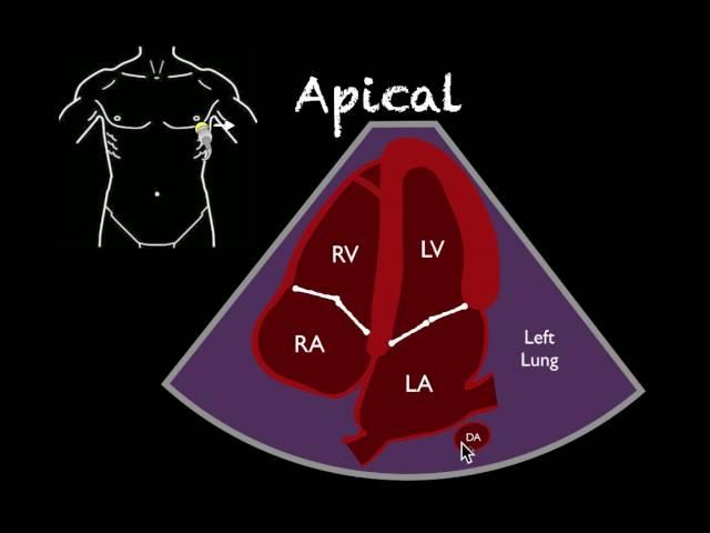 Bedside Ultrasound Basic Cardiac US