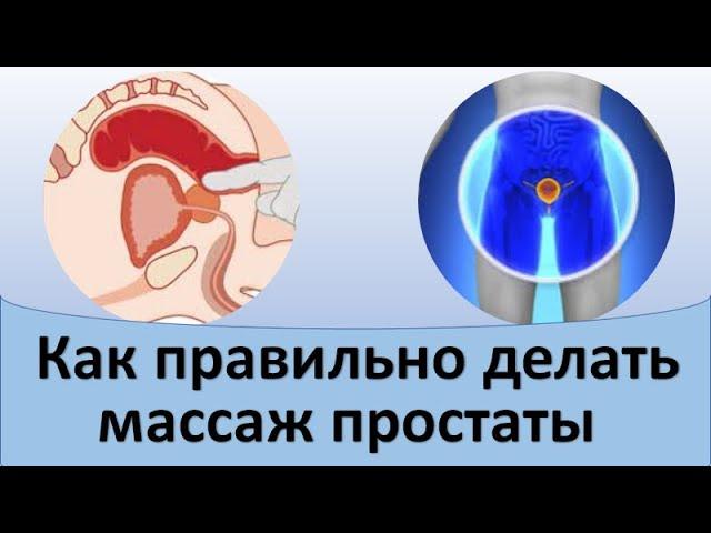 Как правильно делать массаж простаты