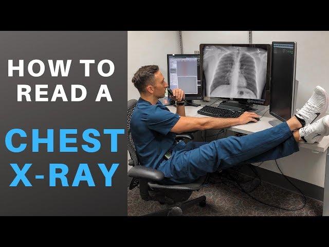 How to Read a Chest X-ray like a Radiologist!  (My Search Pattern)